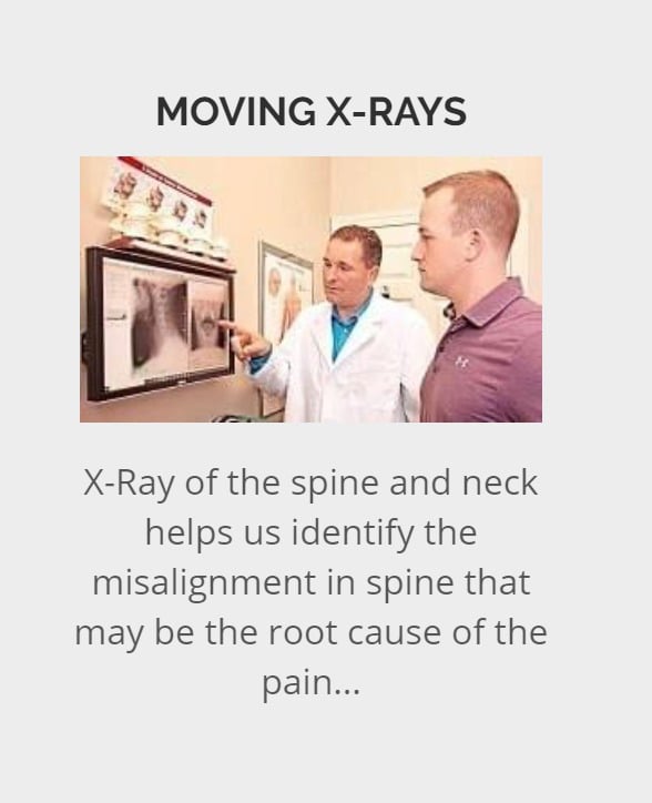 X-ray helps Chiropractors identify the misalignment in Spine